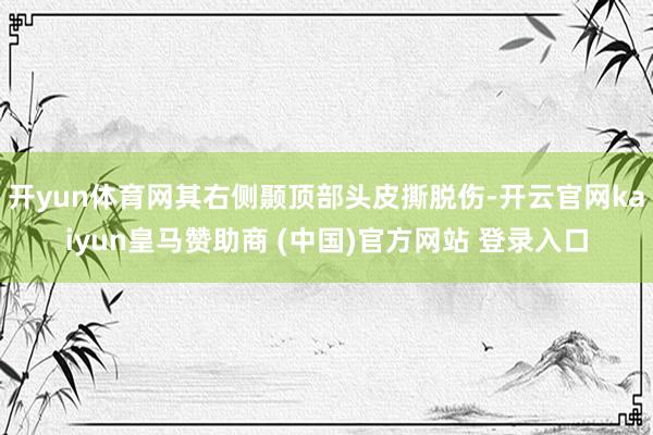 开yun体育网其右侧颞顶部头皮撕脱伤-开云官网kaiyun皇马赞助商 (中国)官方网站 登录入口
